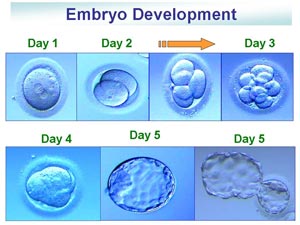 ivf-embryo-development