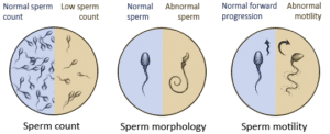 IMSI-Strict-software-aids-in-the-IMSI-process-by-measuring-the-size-and-shape-of-the-sperm-head