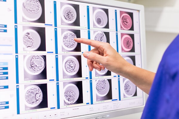 IVF Doctor Looking at Embryoscope Scans at Cyprus IVF Centre